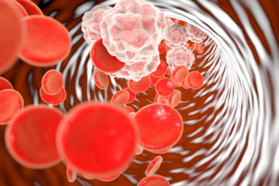 Храни, За Които Е Известно, Че Причиняват Възпаление