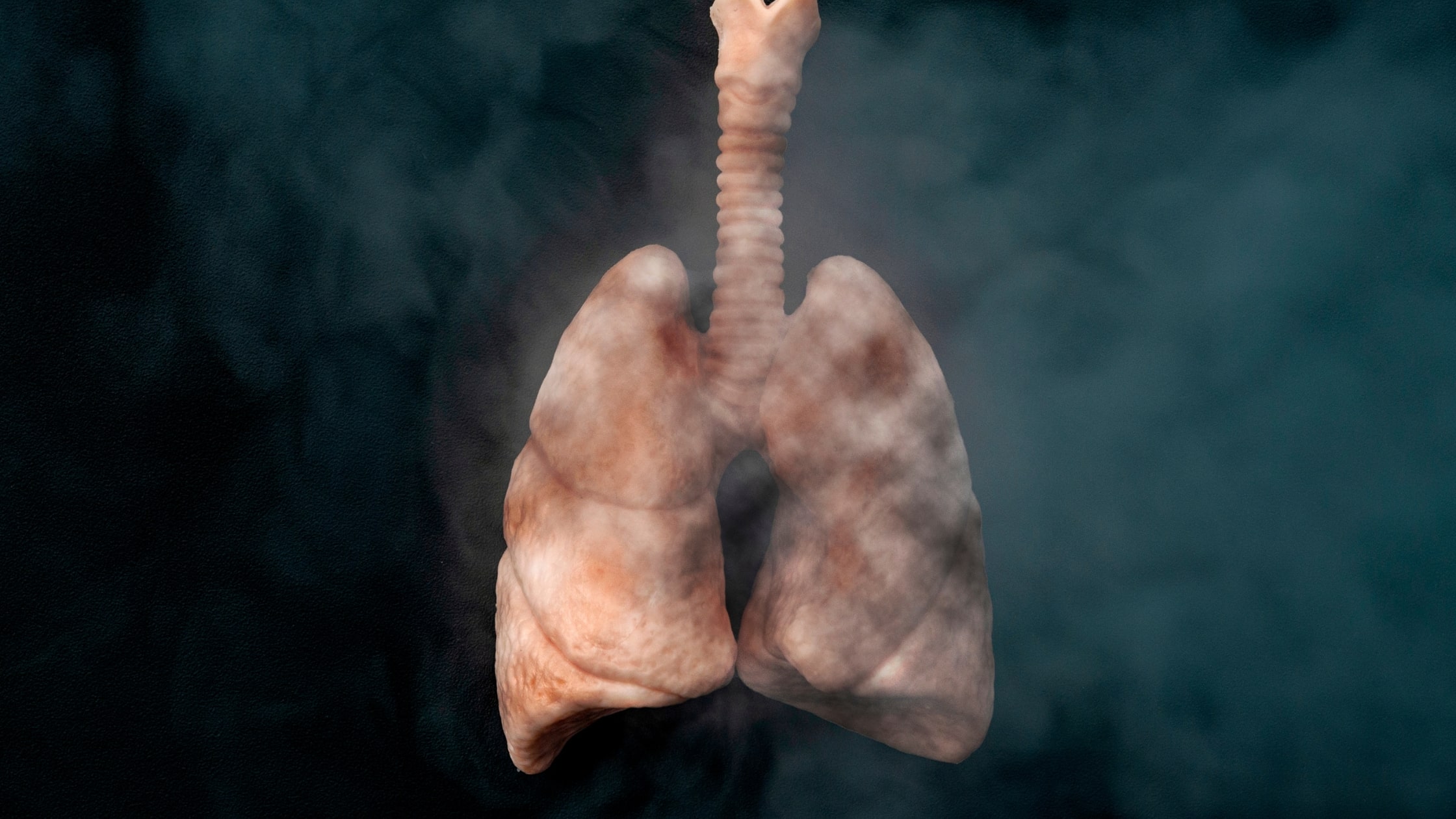 Опасности От Вдишване На Дим