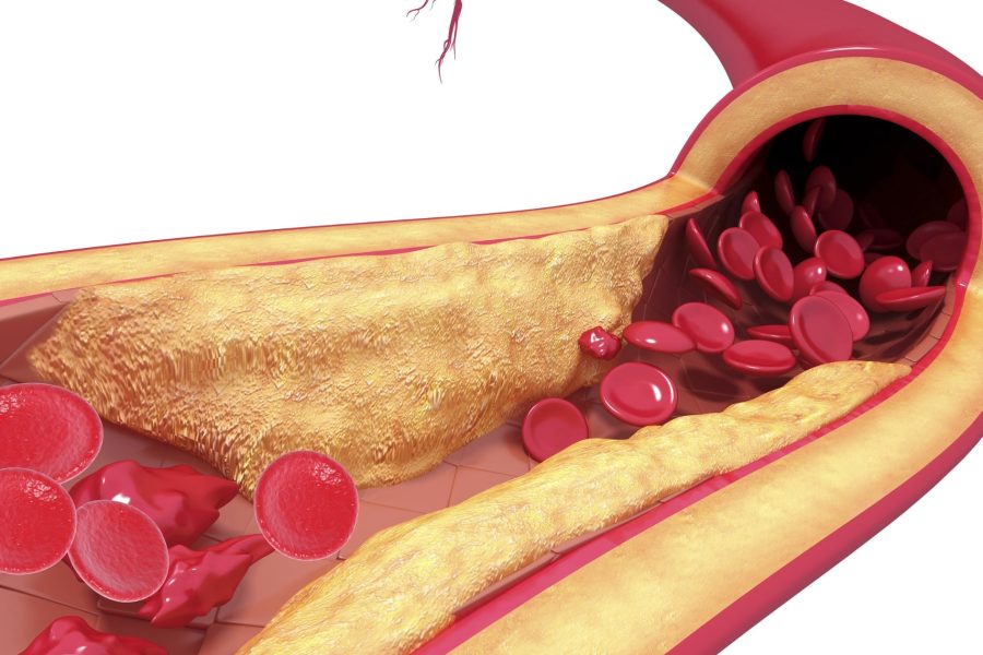 Храни, Които Подобряват Кръвообращението